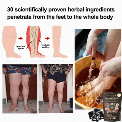 Raindew™ Bee Venom Lymphatic Drainage & Slimming Foot SoakBeads 70% OFF🎉🎉【Doctor recommendation - For all lymphatic problems and obesity】