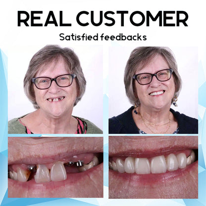 🦷🦷Hermsa™ Denture Silicone Liner Set (Top & Bottom Teeth)😃Confidantiy smile with Reazeal😃