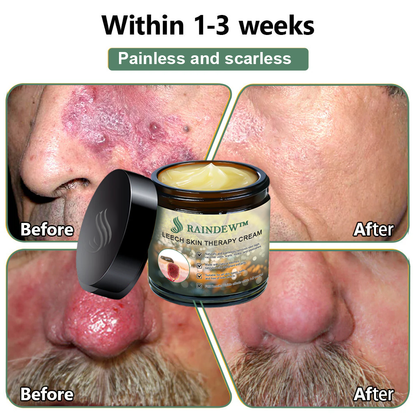 Raindew™ Turmeric Skin Cleansing Pads (AAD Recommended)