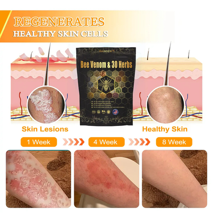 RAINDEW™ Bee Venom & 30-Herb Detox Foot Soak Beads for Body Sculpting- Recommended by the America Lymphatic Academy (ALA) 🧀
