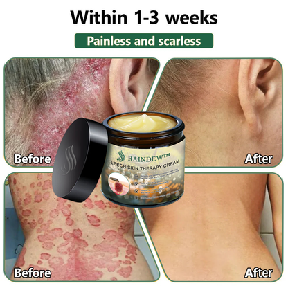Raindew™ Turmeric Skin Cleansing Pads (AAD Recommended)