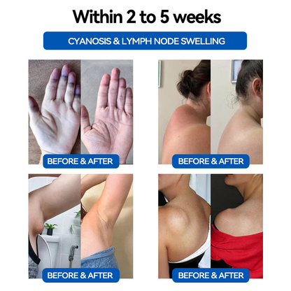 CZTICLE™ Ultrasonic Fat Blasting & Far Infrared Blood Sugar Balancing Detox Wristband(👨‍⚕️Recommended by PlasticSurgeons)