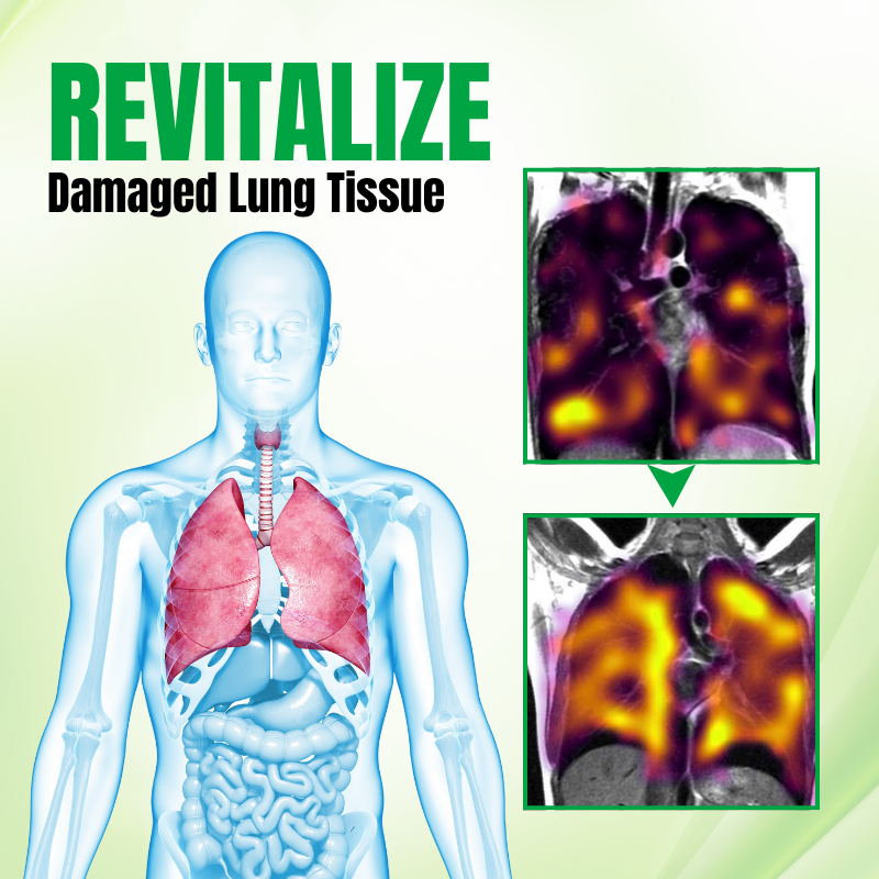 RAINDEW™ RespiPure Herbal Lung Detox Spray