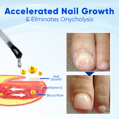 Coolord™ OnyxoGuard Nail Growth and Repair Serum